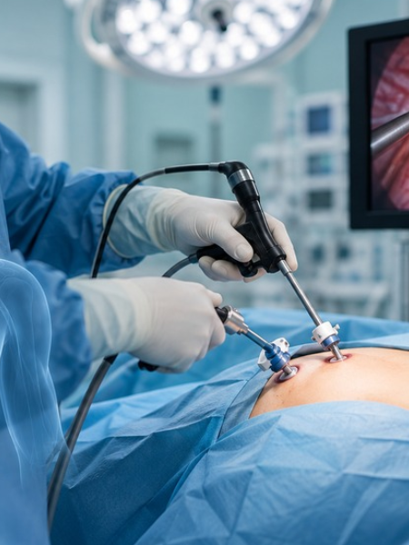 Thoracic Surgery