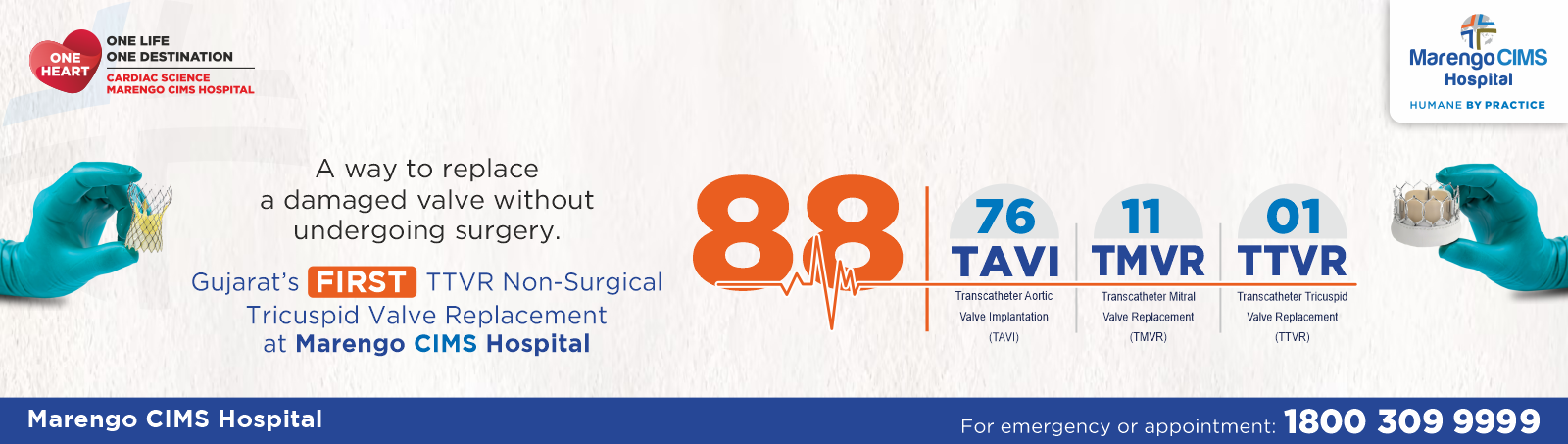 TTVR Non Surgical